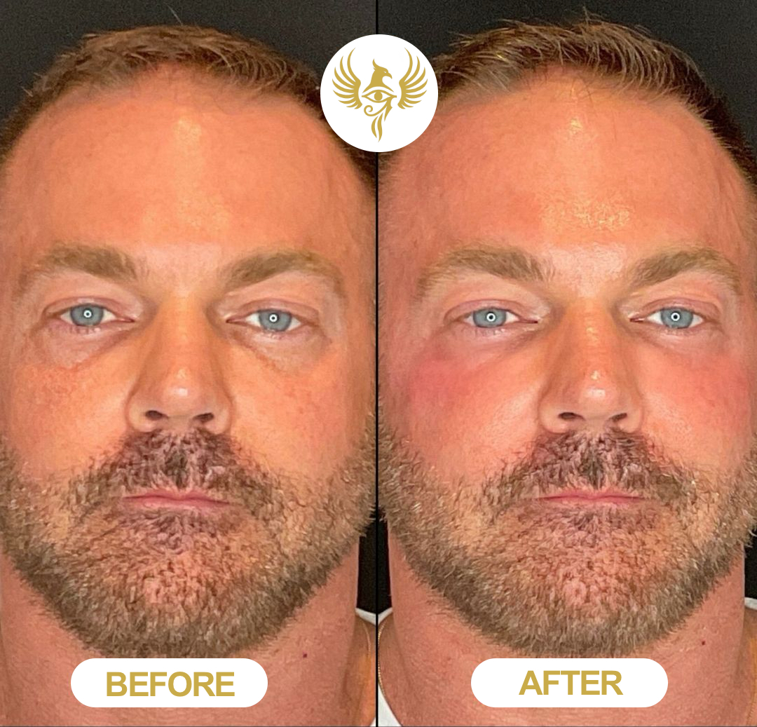 Before and after treatment results