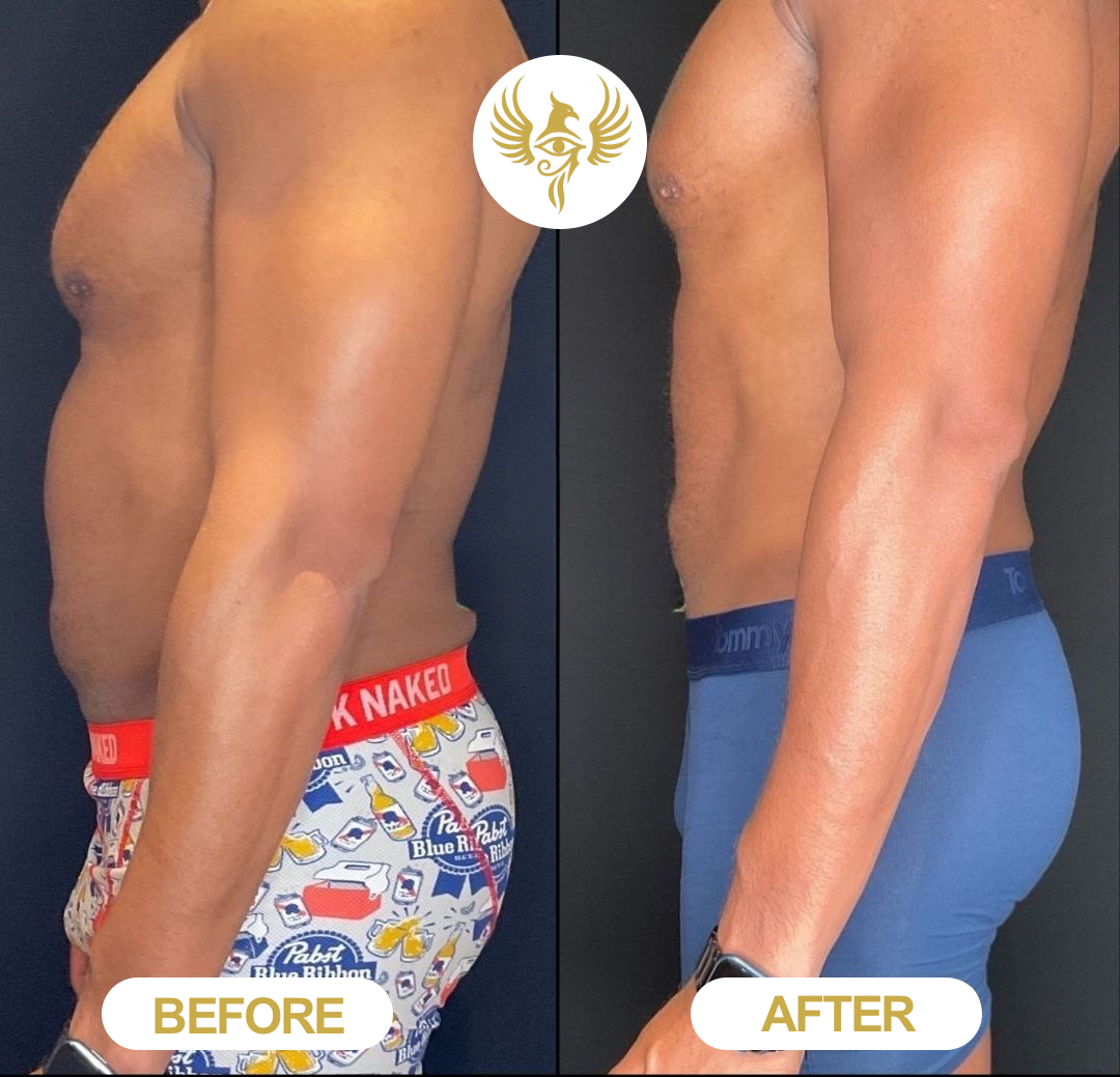 Before and after skin treatment